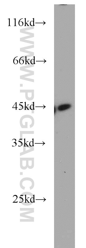 K-562 cells were subjected to SDS PAGE followed by western blot with TARDBP Antibody 12892-1-AP TARDBP western blot WB 12892-1-AP TARDBP Antibody ALS10; TDP-43; Tdp43