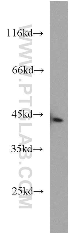 HeLa cells were subjected to SDS PAGE followed by western blot with TARDBP Antibody 12892-1-AP TARDBP western blot WB 12892-1-AP TARDBP Antibody ALS10; TDP-43; Tdp43