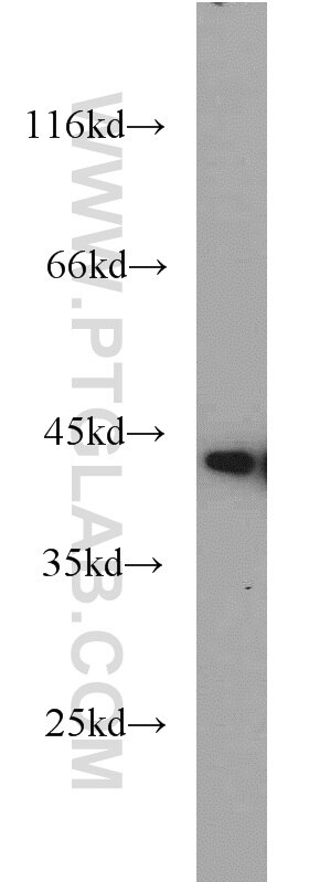 HeLa cells were subjected to SDS PAGE followed by western blot with TARDBP Antibody 12892-1-AP TARDBP western blot WB 12892-1-AP TARDBP Antibody ALS10; TDP-43; Tdp43