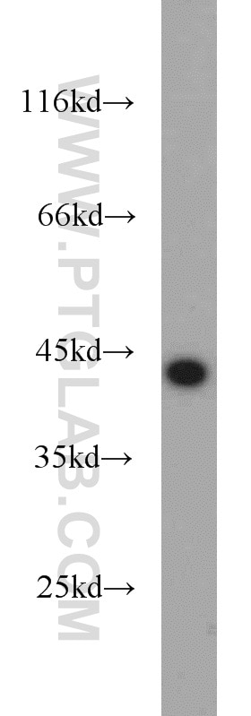 HeLa cells were subjected to SDS PAGE followed by western blot with TARDBP Antibody 12892-1-AP TARDBP western blot WB 12892-1-AP TARDBP Antibody ALS10; TDP-43; Tdp43