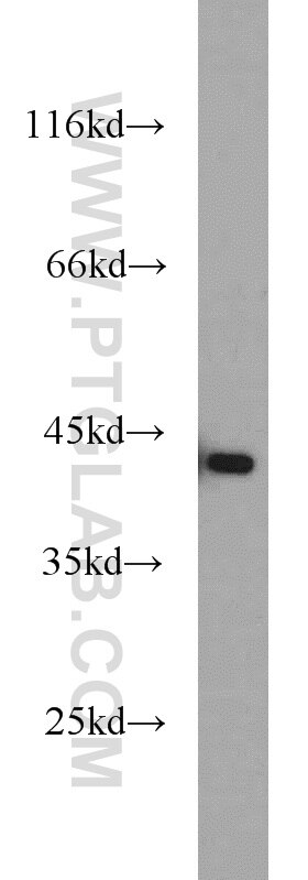 HeLa cells were subjected to SDS PAGE followed by western blot with TARDBP Antibody 12892-1-AP TARDBP western blot WB 12892-1-AP TARDBP Antibody ALS10; TDP-43; Tdp43