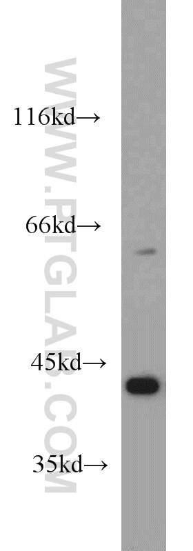 HeLa cells were subjected to SDS PAGE followed by western blot with TARDBP Antibody 12892-1-AP TARDBP western blot WB 12892-1-AP TARDBP Antibody ALS10; TDP-43; Tdp43