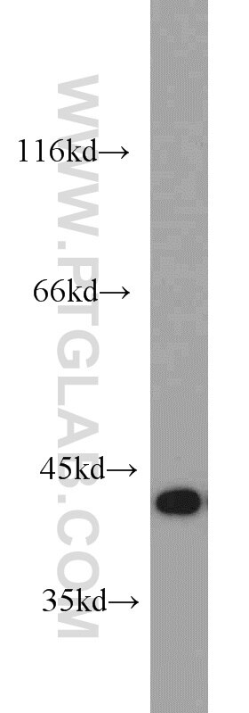 HeLa cells were subjected to SDS PAGE followed by western blot with TARDBP Antibody 12892-1-AP TARDBP western blot WB 12892-1-AP TARDBP Antibody ALS10; TDP-43; Tdp43