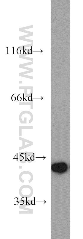 HeLa cells were subjected to SDS PAGE followed by western blot with TARDBP Antibody 12892-1-AP TARDBP western blot WB 12892-1-AP TARDBP Antibody ALS10; TDP-43; Tdp43