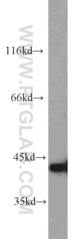 HeLa cells were subjected to SDS PAGE followed by western blot with TARDBP Antibody 12892-1-AP TARDBP western blot WB 12892-1-AP TARDBP Antibody ALS10; TDP-43; Tdp43