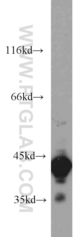 HeLa cells were subjected to SDS PAGE followed by western blot with TARDBP Antibody 12892-1-AP TARDBP western blot WB 12892-1-AP TARDBP Antibody ALS10; TDP-43; Tdp43