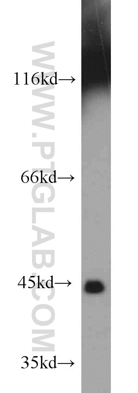mouse pancreas tissue were subjected to SDS PAGE followed by western blot with TARDBP Antibody 12892-1-AP TARDBP western blot WB 12892-1-AP TARDBP Antibody ALS10; TDP-43; Tdp43