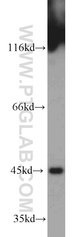 mouse pancreas tissue were subjected to SDS PAGE followed by western blot with TARDBP Antibody 12892-1-AP TARDBP western blot WB 12892-1-AP TARDBP Antibody ALS10; TDP-43; Tdp43