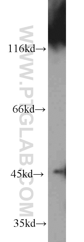 mouse pancreas tissue were subjected to SDS PAGE followed by western blot with TARDBP Antibody 12892-1-AP TARDBP western blot WB 12892-1-AP TARDBP Antibody ALS10; TDP-43; Tdp43