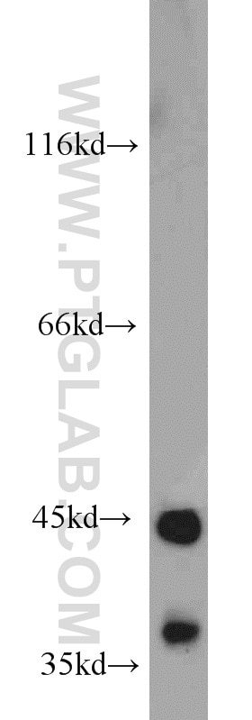 mouse pancreas tissue were subjected to SDS PAGE followed by western blot with TARDBP Antibody 12892-1-AP TARDBP western blot WB 12892-1-AP TARDBP Antibody ALS10; TDP-43; Tdp43