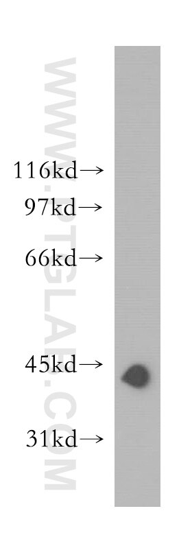 human heart tissue were subjected to SDS PAGE followed by western blot with TARDBP Antibody 12892-1-AP TARDBP western blot WB 12892-1-AP TARDBP Antibody ALS10; TDP-43; Tdp43