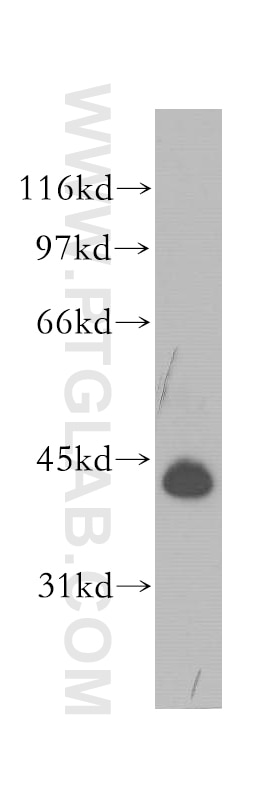 HeLa cells were subjected to SDS PAGE followed by western blot with TARDBP Antibody 12892-1-AP TARDBP western blot WB 12892-1-AP TARDBP Antibody ALS10; TDP-43; Tdp43