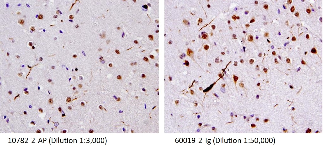 TARDBP IHC 60019-2-Ig TARDBP Antibody TARDBP;ALS10;TDP-43;Tdp43 ;TDP 43