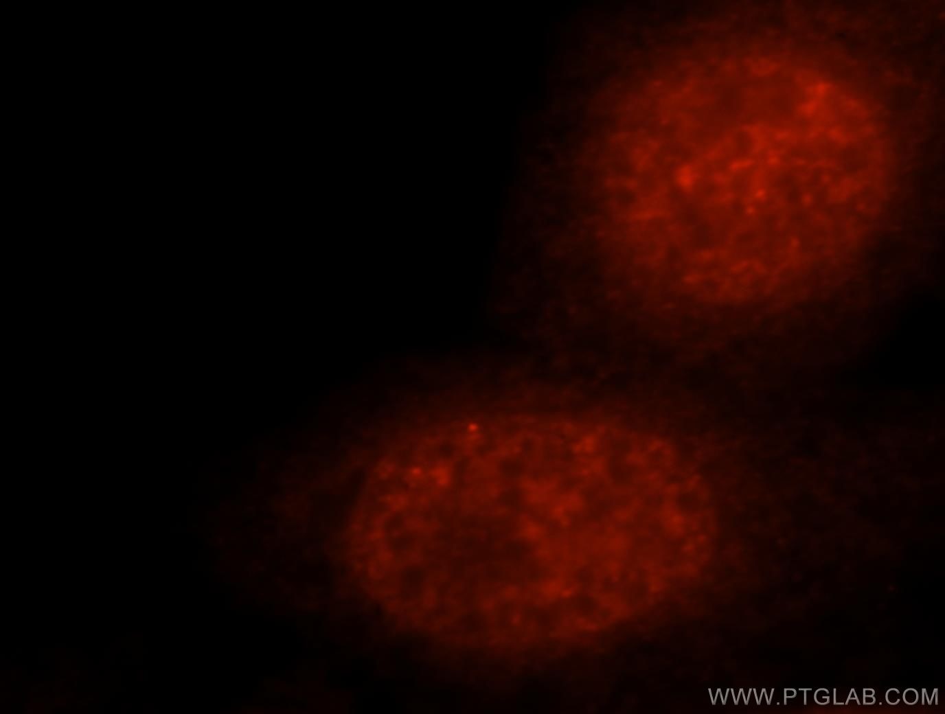 TARDBP Immunofluorescence IF 60019-2-Ig TARDBP Antibody TARDBP;ALS10;TDP-43;Tdp43 ;TDP 43