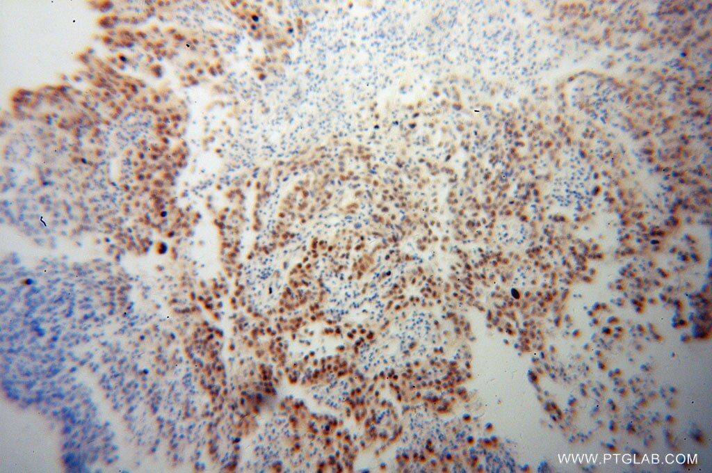 TARDBP IHC Immunohistochemical 60019-2-Ig TARDBP Antibody TARDBP;ALS10;TDP-43;Tdp43 ;TDP 43