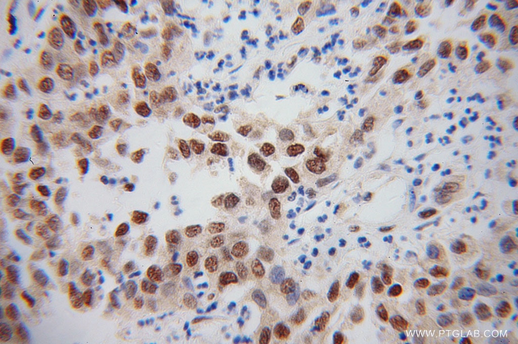 TARDBP IHC Immunohistochemical 60019-2-Ig TARDBP Antibody TARDBP;ALS10;TDP-43;Tdp43 ;TDP 43