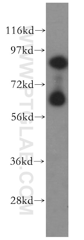 TAX1BP1 western blot WB 14424-1-AP TAX1BP1 Antibody CALCOCO3; T6BP; TXBP151