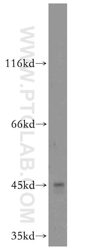 BxPC-3 cells were subjected to SDS PAGE followed by western blot with 13346-1-AP(TBRG1 Antibody) at dilution of 1:500 TBRG1 western blot WB 13346-1-AP TBRG1 Antibody FLJ14621; FLJ25020; FLJ90113; MGC129890; NIAM; TB-5
