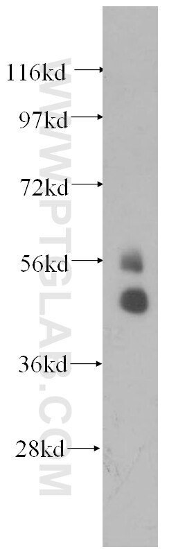 TBX22 western blot WB 11133-1-AP TBX22 Antibody CLPA; TBXX; dJ795G23.1
