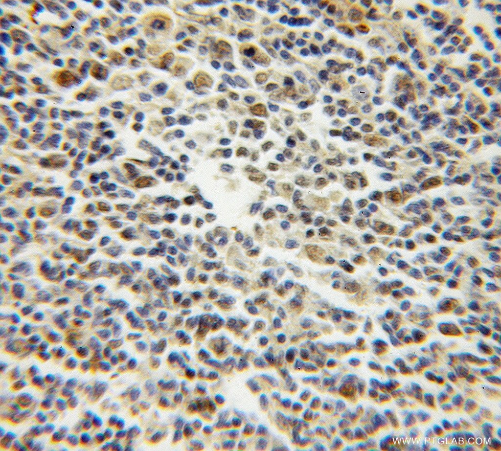 TCOF1 IHC Immunohistochemical 11003-1-AP TCOF1 Antibody MFD1; treacle