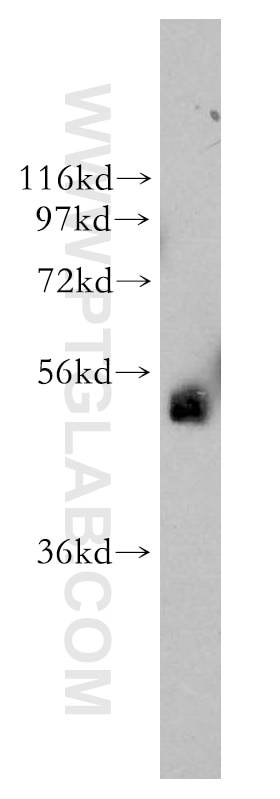 MCF7 cells were subjected to SDS PAGE followed by western blot with 13183-1-AP(TFAP2B Antibody) at dilution of 1:800 TFAP2B western blot WB 13183-1-AP TFAP2B Antibody AP-2B; AP2-B; MGC21381