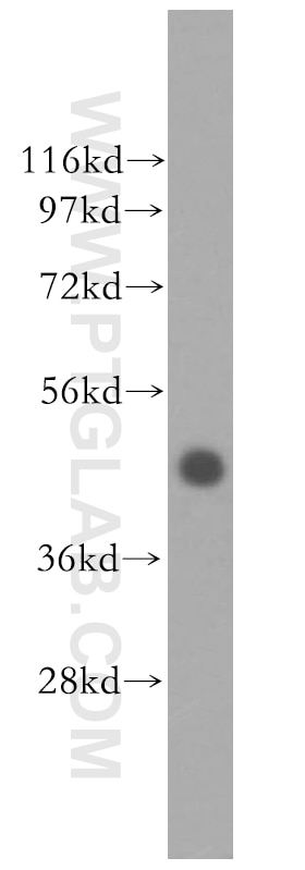 human brain tissue were subjected to SDS PAGE followed by western blot with 11500-1-AP(TFDP2 Antibody) at dilution of 1:600 TFDP2 western blot WB 11500-1-AP TFDP2 Antibody DP2; Dp-2
