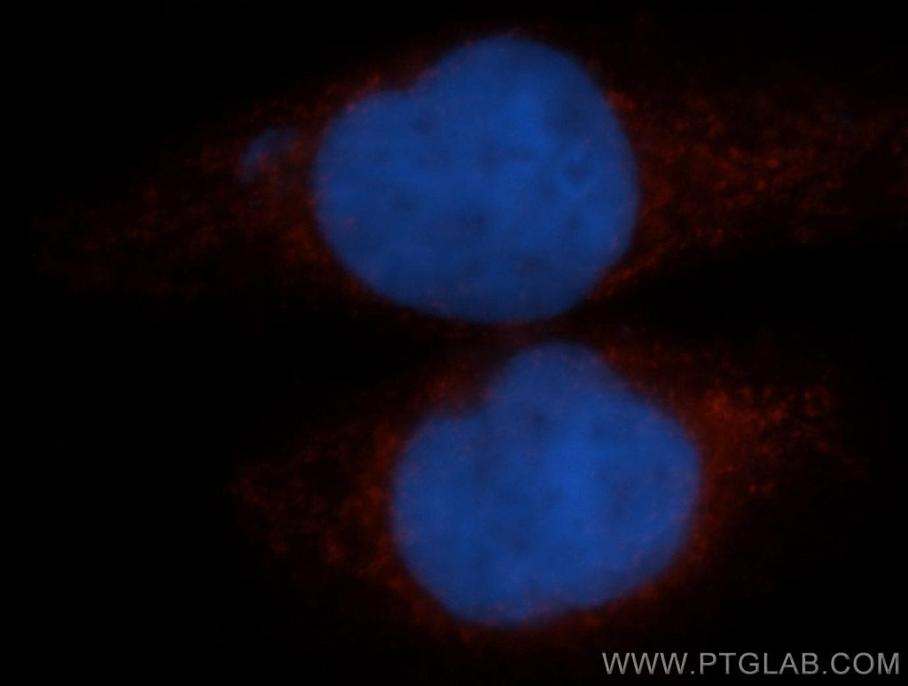 TFEB Immunofluorescence IF 13372-1-AP TFEB Antibody AlphaTFEB; TCFEB; bHLHe35