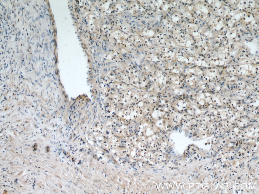 TFEB IHC Immunohistochemical 13372-1-AP TFEB Antibody AlphaTFEB; TCFEB; bHLHe35