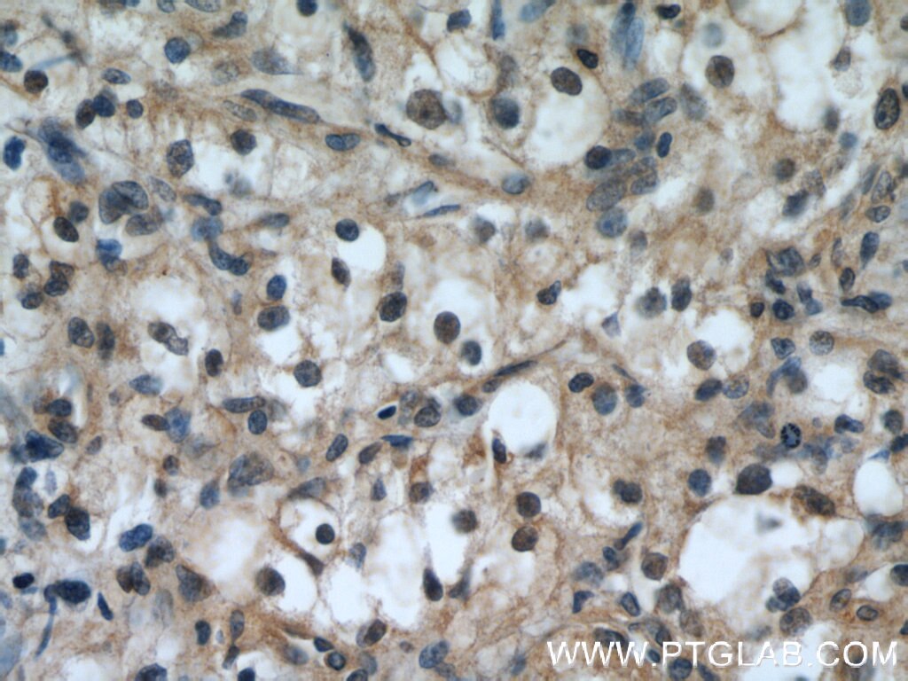 TFEB IHC Immunohistochemical 13372-1-AP TFEB Antibody AlphaTFEB; TCFEB; bHLHe35