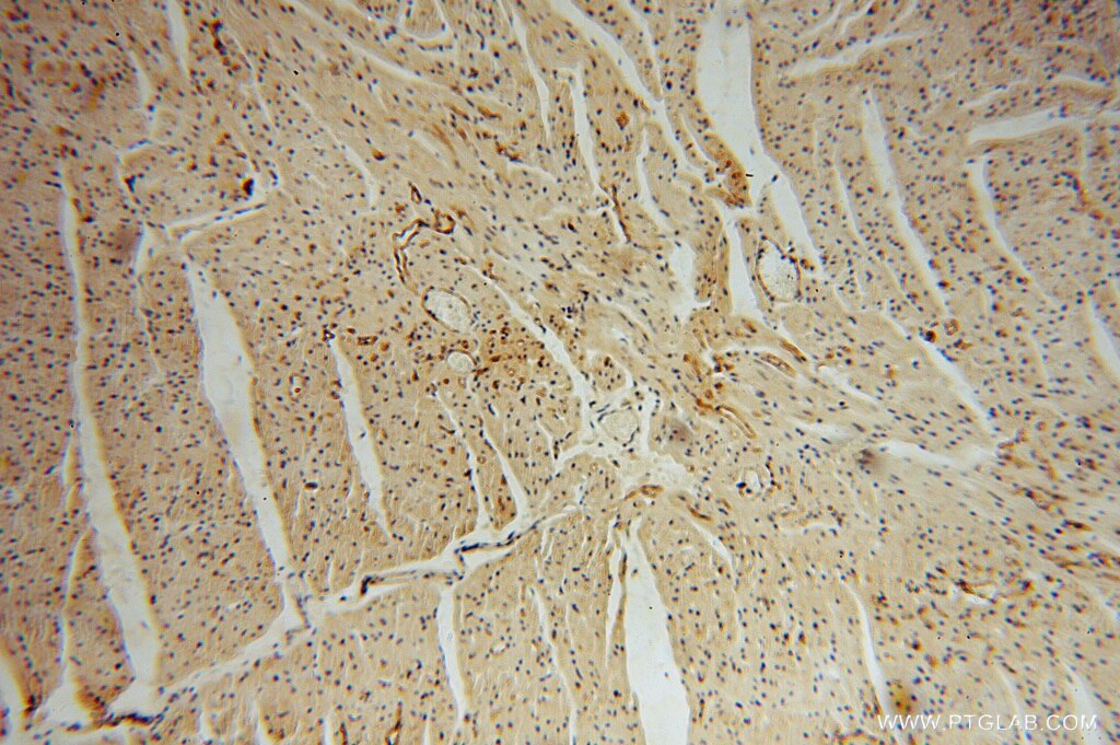 THBD IHC Immunohistochemical 14318-1-AP THBD Antibody CD141; THRM; TM