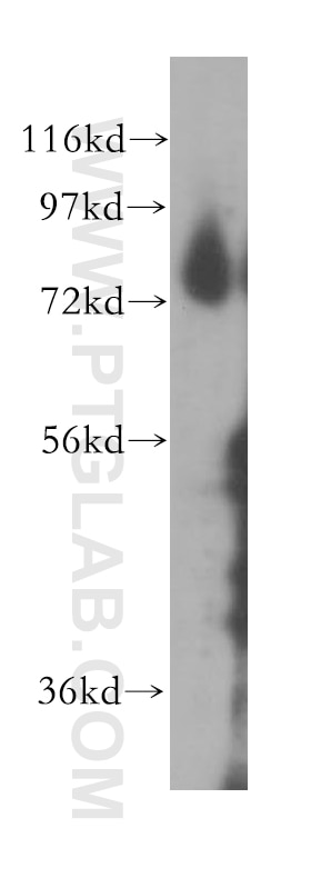 human placenta tissue were subjected to SDS PAGE followed by western blot with 11738-1-AP(THOP1 Antibody) at dilution of 1:1000 THOP1 western blot WB 11738-1-AP THOP1 Antibody EP24.15; MEPD_HUMAN; MP78; TOP