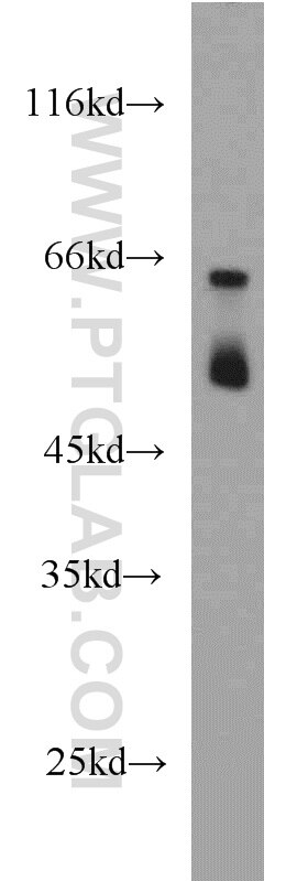 THRA western blot WB 10139-1-AP THRA Antibody AR7; EAR7; ERB-T-1; ERBA; ERBA1; MGC000261; MGC43240; NR1A1; THRA1; THRA2; c-ERBA-1