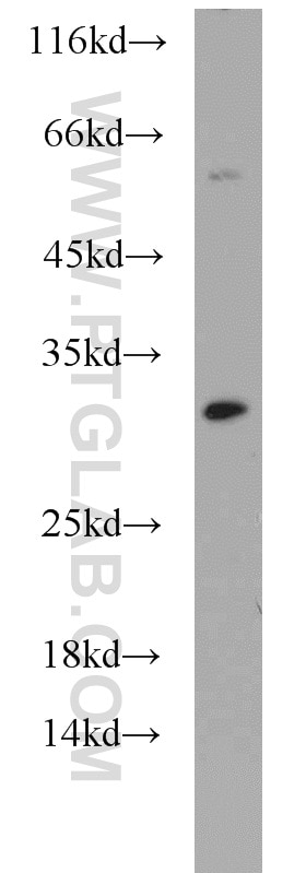 Raji cells were subjected to SDS PAGE followed by western blot with 10753-1-AP(TIMP1 Antibody) at dilution of 1:500 TIMP1 western blot WB 10753-1-AP TIMP1 Antibody CLGI; EPA; EPO; FLJ90373; HCI; TIMP