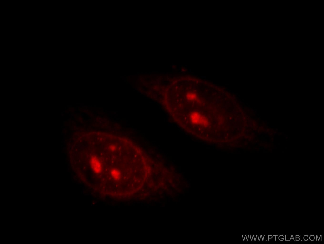 TIN2 Immunofluorescence IF 11368-1-AP TIN2 Antibody TIN2; TIN2L