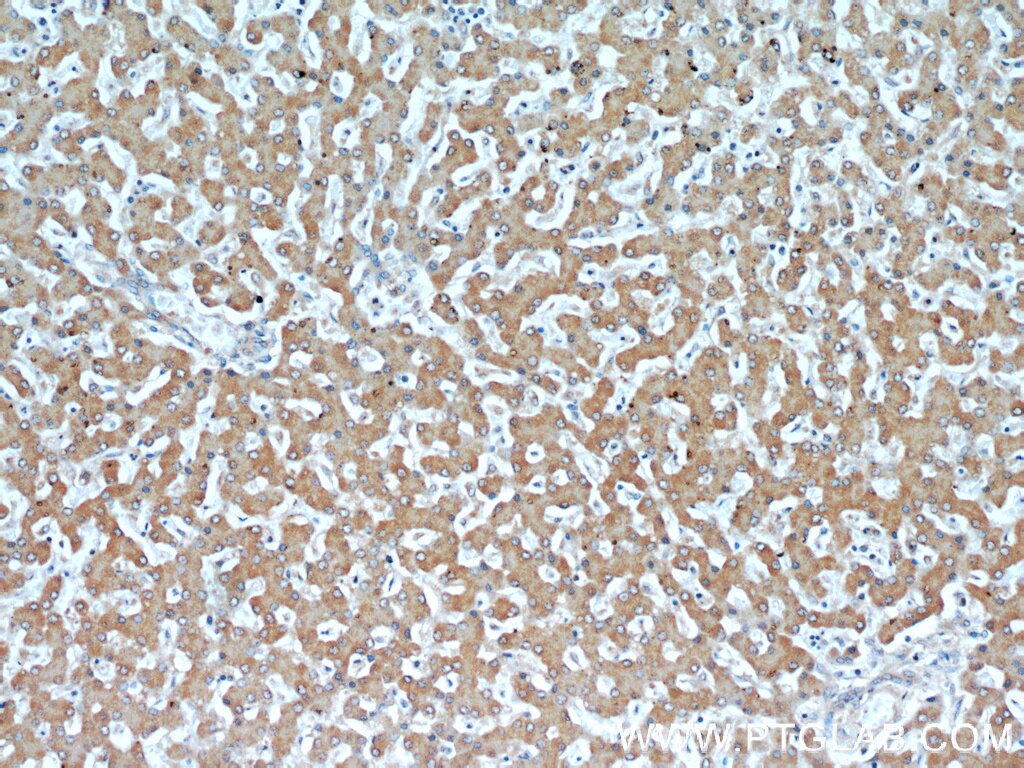 TKT IHC Immunohistochemical 66016-1-Ig TKT Antibody FLJ34765; TKT1