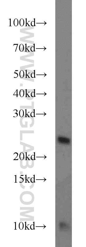 HepG2 cells were subjected to SDS PAGE followed by western blot with 21902-1-AP(TMED3 Antibody) at dilution of 1:1000 TMED3 western blot WB 21902-1-AP TMED3 Antibody C15orf22; MGC133022; P24B