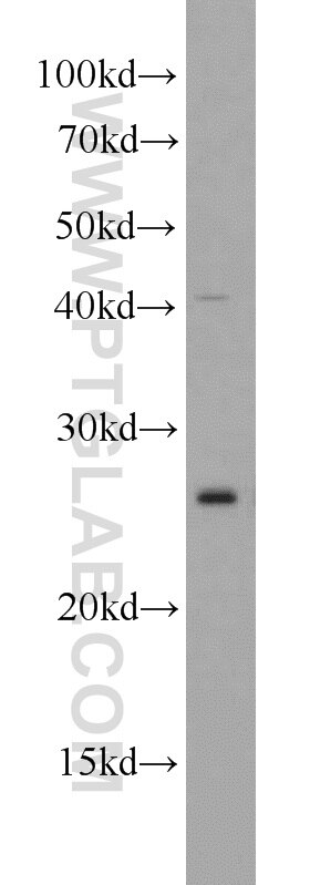 mouse liver tissue were subjected to SDS PAGE followed by western blot with 14141-1-AP(TMED4 Antibody) at dilution of 1:300 TMED4 western blot WB 14141-1-AP TMED4 Antibody ERS25; HNLF