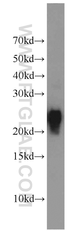 HL-60 cells were subjected to SDS PAGE followed by western blot with 10500-1-AP(TMS1 Antibody) at dilution of 1:1000 TMS1 western blot WB 10500-1-AP TMS1 Antibody ASC; CARD5; MGC10332; TMS; TMS-1; TMS1