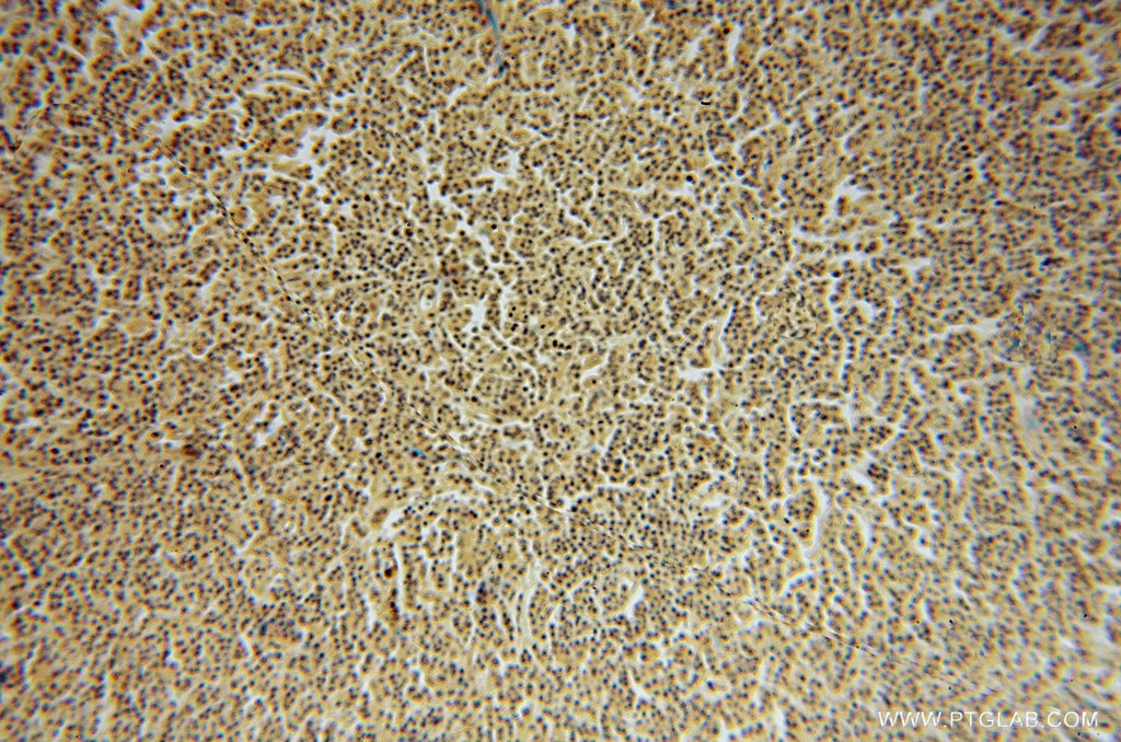 TNFAIP8L2 IHC Immunohistochemical 15940-1-AP TNFAIP8L2 Antibody FLJ23467; TIPE2