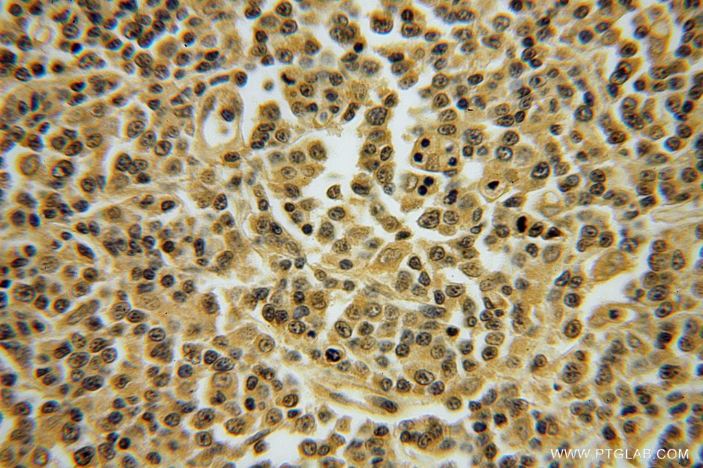 TNFAIP8L2 IHC Immunohistochemical 15940-1-AP TNFAIP8L2 Antibody FLJ23467; TIPE2