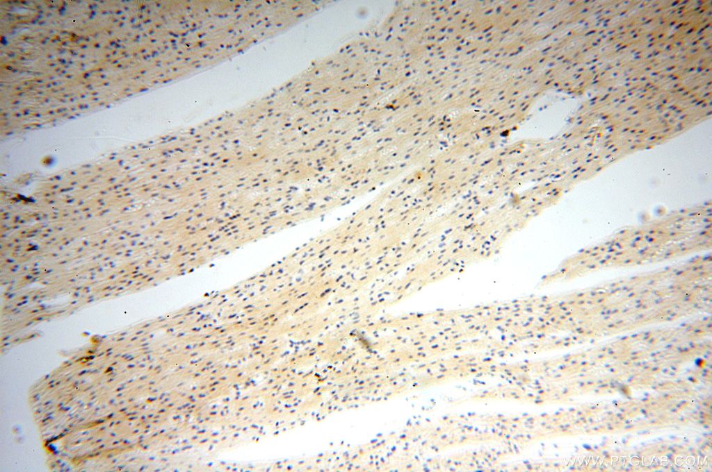 TNNI1 IHC Immunohistochemical 16102-1-AP TNNI1 Antibody DKFZp451O223; SSTNI; TNN1