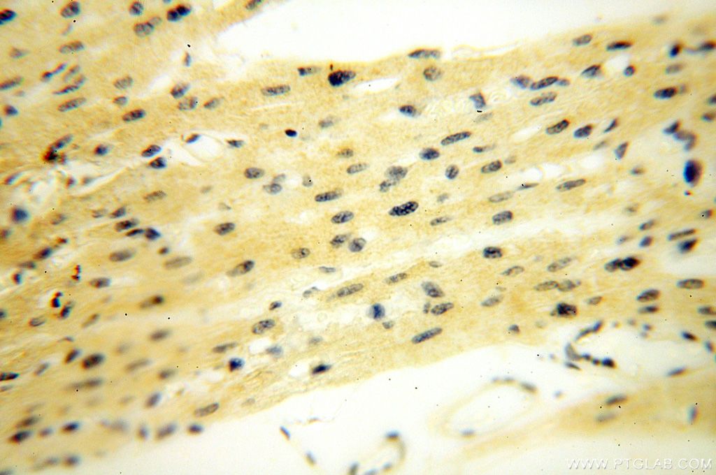 TNNI1 IHC Immunohistochemical 16102-1-AP TNNI1 Antibody DKFZp451O223; SSTNI; TNN1