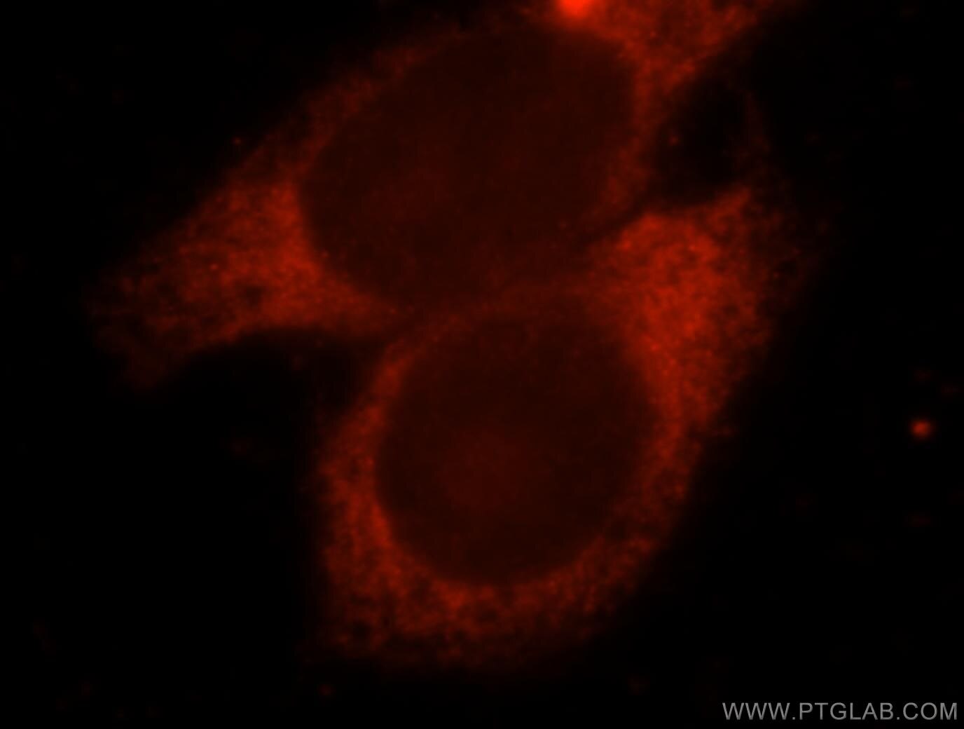 Immunofluorescent analysis of HepG2 cells, using TNNT2 antibody 15513-1-AP at 1:25 dilution and Rhodamine-labeled goat anti-rabbit IgG (red). TNNT2 Immunofluorescence IF 15513-1-AP TNNT2 Antibody CMH2; CMPD2; MGC3889; RCM3; TnTC; cTnT