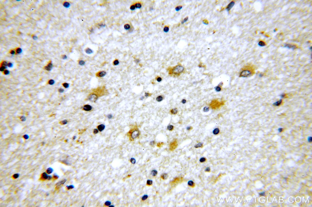TNR-Specific IHC Immunohistochemical 19730-1-AP TNR-Specific Antibody MGC149328; TN-R