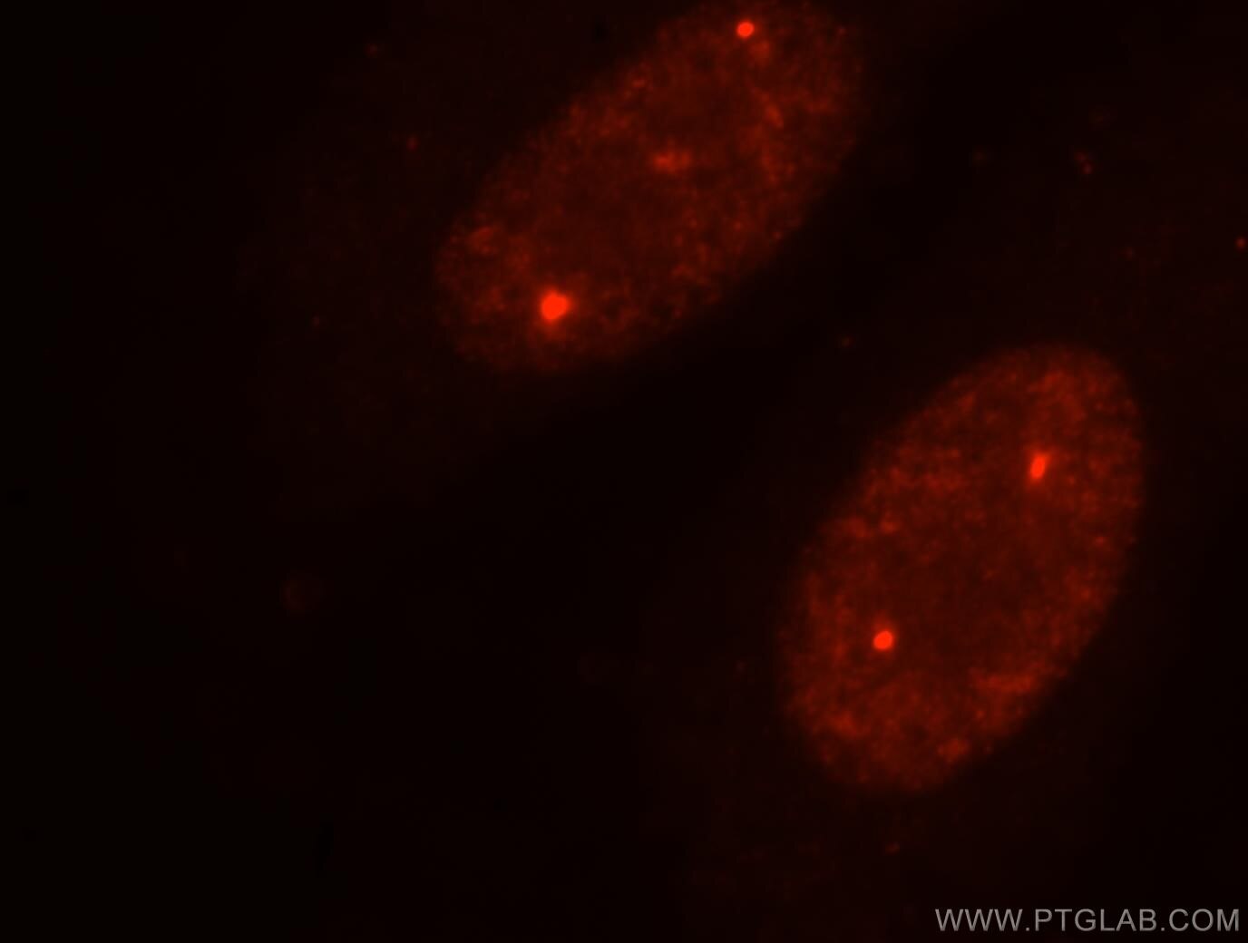 TOE1 Immunofluorescence IF 16203-1-AP TOE1 Antibody FLJ13949