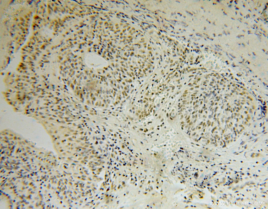 TOE1 IHC Immunohistochemical 16203-1-AP TOE1 Antibody FLJ13949