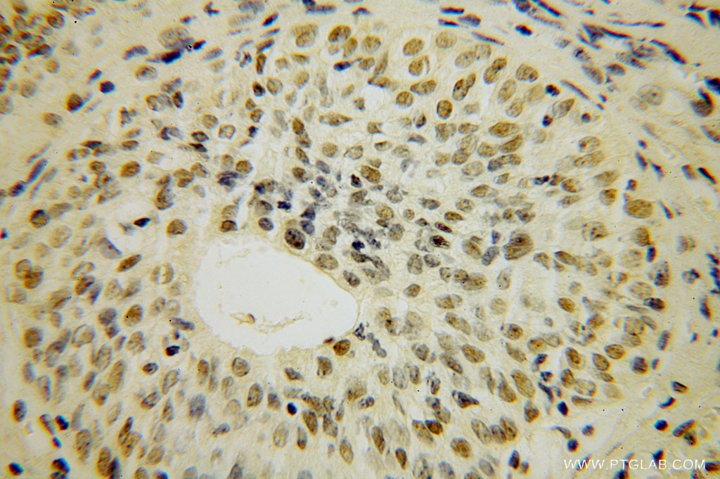 TOE1 IHC Immunohistochemical 16203-1-AP TOE1 Antibody FLJ13949