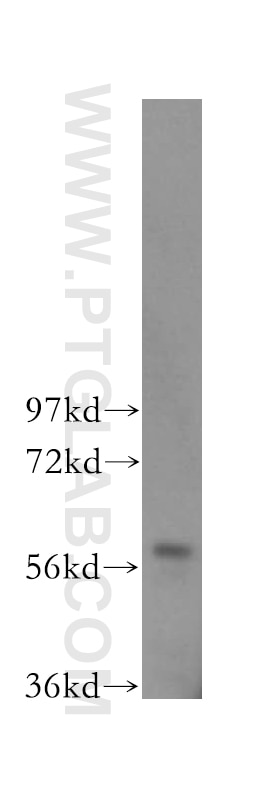 TOE1 western blot WB 16203-1-AP TOE1 Antibody FLJ13949