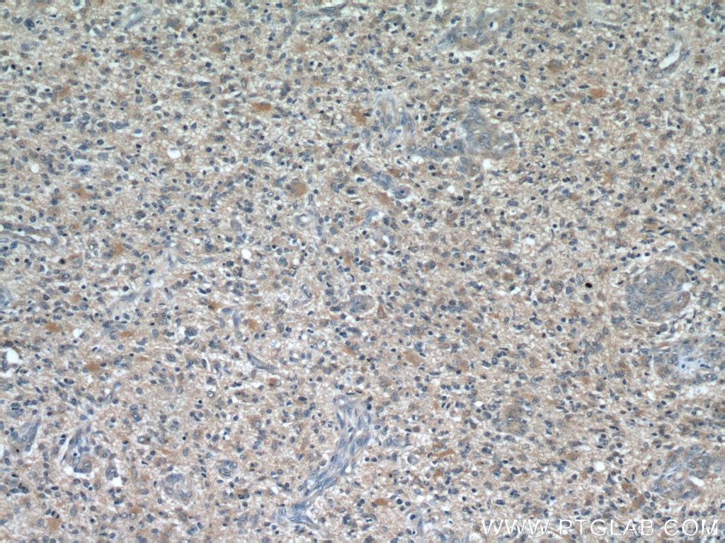 TOMM7 IHC Immunohistochemical 15071-1-AP TOMM7 Antibody TOM7