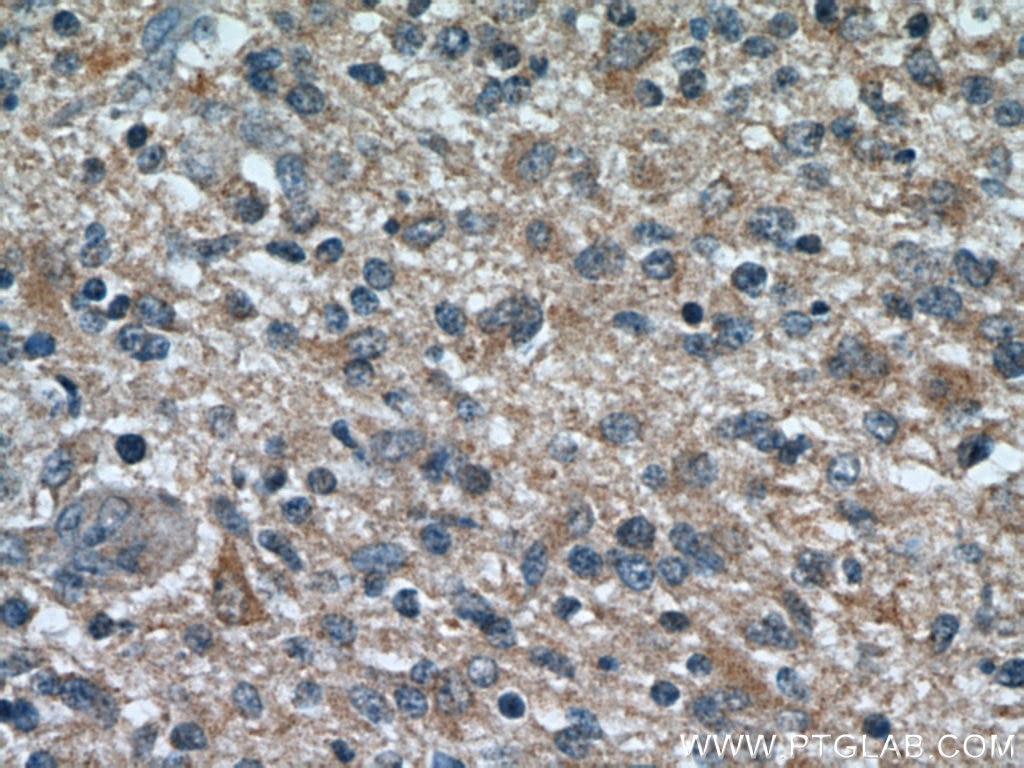 TOMM7 IHC Immunohistochemical 15071-1-AP TOMM7 Antibody TOM7